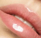 relleno labios zaragoza