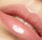 relleno labios zaragoza
